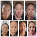 인셀덤화장품 인셀덤 더마톨로지 사용 후기 건조했던 내 피부의 물광피부로 변화