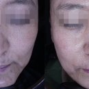 강남타토아의원 이미지