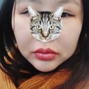 늘편안의원 | 신사역 피부과 하이미의원 입술필러 후기