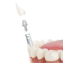 미치과의원 이미지