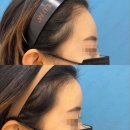 신촌홍대 라마르성형외과의원 이미지