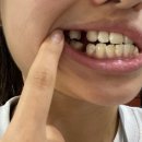 배성민치과교정과치과의원 | 대구 배성민 교정치과 추천 치아교정 후기