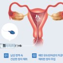 수정-1 이미지