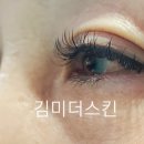 김미더스킨