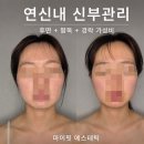 마이핏 | 연신내 신부관리 경락 풀코스 마이핏 에스테틱 솔직후기