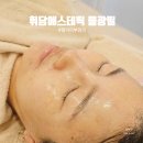 롯데리아 명지점 | 명지피부관리 물광필 휘담에스테틱 전후 솔직 후기