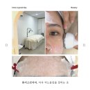 블랙차차 | 마곡 여드름압출 잘하는 곳 퓨어스킨차차 후기, 마곡나루 압출부터 발산 여드름 압출까지 만족하고 왔어요