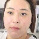대전 둔산동 피부국가자격증속성수강 가능한 뷰마르 둔산점에서 필링 관리받은 후기