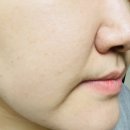 대왕의료기 | 에스테틱 화장품 옥시티컬 바이알 3.98 캄비아 사용 후기