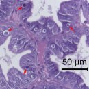 흰다리새우의 RNA바이러스 Wenzhou shrimp virus 8 (WzSV8) 이미지
