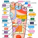 수족냉증,내향성발톱,무지외반증,굳은살,통풍 등등 이미지