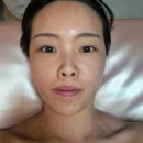 호원로 | 마산 내서 피부관리실 에스테틱 밍스킨케어 플라즈마 화이트토닝 솔직후기 재방문예약