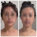 너정골 | 안산 고잔동 피부관리【지현뷰티】비대칭 윤곽관리에는 두골비 피부회복에는 에르모듀 안산문제성피부관리