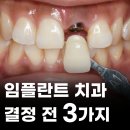 새망미메디칼빌딩 | 망미동임플란트잘하는곳 기준 3가지 (심미, 수술, 사후관리)