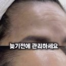 월드크리닝진해지사 | 김해 이마 주름, 눈 뜨는 힘 약해서 보톡스 알아보고 계시다면 그 전에 이것부터 꼭 보세요!