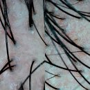 마이올가 | [부산 기장]정관피부관리 - 올가드림뷰티 정관모전점에서 두피디톡스 받은 후기