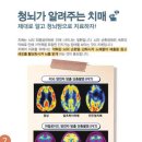 청뇌한의원 이미지