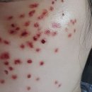 최원용비뇨기과