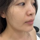 대영간판전문 | 울산 달동 피부관리 윤결뷰티 물방울관리 받고 피부결 좋아진 후기