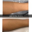 [울산북구]왁싱 잘하는곳 뷰티바이연에서 팔 왁싱 받은 후기 !