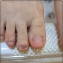 닥터아이티엔네일파라티