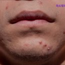 미소핀피부과의원 이미지