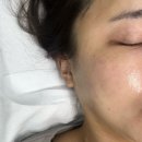 쏘닉 | 대구 피부관리 추천 [정보떼뷰티샵] 듀얼쏘닉물방울 관리 후기