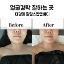 [대전피부관리 다경미힐링스킨앤바디]얼굴경락 잘하는 곳