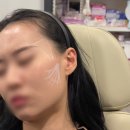 닉스의원 | 대전피부과 잘하는곳 닉스의원 원장이 직접 설명하는 피부좋아지는 어려보이는 시술 콜라겐부스터 필러...
