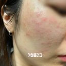 명품앤네이처 | 올리브영 수분크림 추천 에스네이처 아쿠아스쿠알란 수분크림 5년 사용후기 수부지 건성피부 사용가능