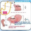 위암 수술 후 부족해지는 비타민? 비타민 B12결핍증 치료는 필수! 이미지