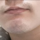 송준호레이메디의원 이미지