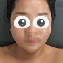 이경화 | 부평피부관리 이경화에스테틱에서 윤곽관리 받은후기