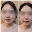 양자에너지체험방 | 하남 부종, 탄력에 탁월한 에너지 특수 관리 예방원 에스테틱