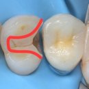 그린치과기공소 이미지