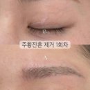 솔앤브로우