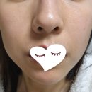 명동역지하상가 | 명동역 피부과 이중턱 티타늄 레이저 리프팅 60kj 받고 온 후기(효과, 통증)