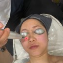 압구정 탈모치료 피부과 피코트리플 인어젯 원조 기미 주근깨 만족