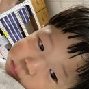 [육아] 24개월 손가락 꼬매기 ㅠㅠ 당진종합병원응급실과 아나파본의원 후기 ‼️