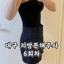 6 | 대구 지방분해주사 복부 다이어트 6회차 마지막 후기