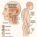만성 통증 이미지