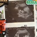 하나초음파테크 이미지