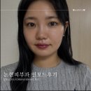 - | [내돈내산] 논현피부과추천 인모드후기