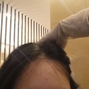정창환카크리닉 | 문지동 두피관리 메이스파에서 두피케어 두피/탈모 5D데톡스 + 정밀검사 후기