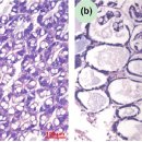 양식 흰다리새우 근육백탁병의 Photobacterium damselae subsp. damselae. 이미지