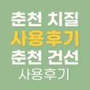 춘천치질 사용후기 3명 / 춘천건선 사용후기 3명