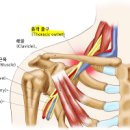 손 저릴때 손저림 원인 관리 이미지