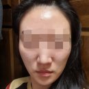 5 | ⭐️스컬트라 5병⭐️ 내돈내산 후기💉