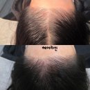 조이헤어 | 용인 조이브로우 헤어라인 후기🙂 흑채 졸업했어요✨