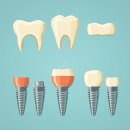 강동뉴욕치과의원 이미지